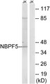 NBPF5P Antibody - Western blot analysis of lysates from Jurkat cells, using NBPF5 Antibody. The lane on the right is blocked with the synthesized peptide.