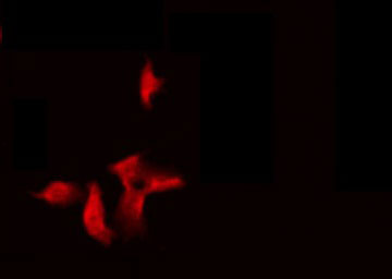 NBPF5P Antibody - Staining HeLa cells by IF/ICC. The samples were fixed with PFA and permeabilized in 0.1% Triton X-100, then blocked in 10% serum for 45 min at 25°C. The primary antibody was diluted at 1:200 and incubated with the sample for 1 hour at 37°C. An Alexa Fluor 594 conjugated goat anti-rabbit IgG (H+L) Ab, diluted at 1/600, was used as the secondary antibody.