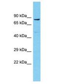 NBPF6 Antibody - NBPF6 antibody Western Blot of THP-1. Antibody dilution: 1 ug/ml.  This image was taken for the unconjugated form of this product. Other forms have not been tested.