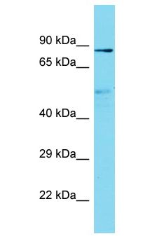 NBPF6 Antibody - NBPF6 antibody Western Blot of Fetal Lung. Antibody dilution: 1 ug/ml.  This image was taken for the unconjugated form of this product. Other forms have not been tested.