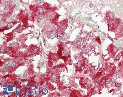 NBR1 Antibody - Human Adrenal: Formalin-Fixed, Paraffin-Embedded (FFPE).  This image was taken for the unconjugated form of this product. Other forms have not been tested.