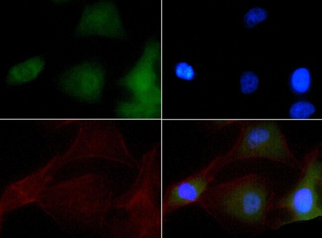 NBR1 Antibody - Immunocytochemistry/Immunofluorescence: NBR1 Antibody - NBR1 antibody was tested at 1:50 in HeLa cells with FITC (green). Nuclei and actin were counterstained with Dapi (blue) and Phalloidin (red).  This image was taken for the unconjugated form of this product. Other forms have not been tested.
