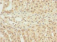 NBR1 Antibody - Immunohistochemistry of paraffin-embedded human adrenal gland tissue at dilution 1:100
