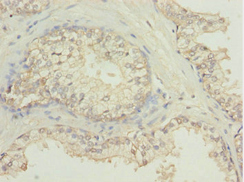 NBR1 Antibody - Immunohistochemistry of paraffin-embedded human prostate tissue at dilution 1:100