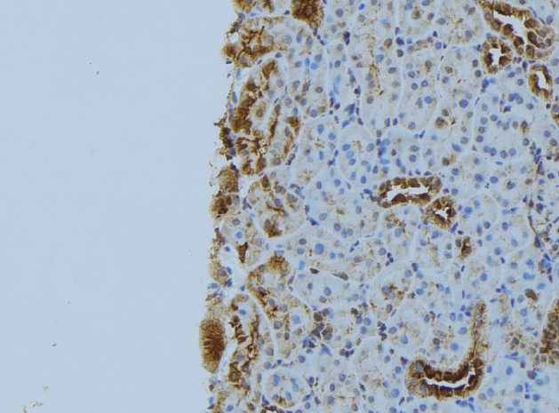 NBR1 Antibody - 1:100 staining mouse kidney tissue by IHC-P. The sample was formaldehyde fixed and a heat mediated antigen retrieval step in citrate buffer was performed. The sample was then blocked and incubated with the antibody for 1.5 hours at 22°C. An HRP conjugated goat anti-rabbit antibody was used as the secondary.