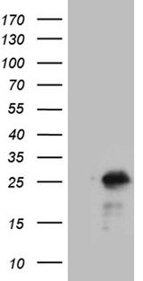 NCALD / Neurocalcin Delta Antibody - HEK293T cells were transfected with the pCMV6-ENTRY control. (Left lane) or pCMV6-ENTRY NCALD. (Right lane) cDNA for 48 hrs and lysed