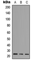 NCALD / Neurocalcin Delta Antibody - Western blot analysis of NCALD expression in HeLa (A); NS-1 (B); H9C2 (C) whole cell lysates.
