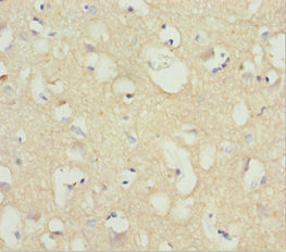 NCALD / Neurocalcin Delta Antibody - Immunohistochemistry of paraffin-embedded human brain tissue at dilution 1:100