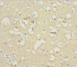 NCALD / Neurocalcin Delta Antibody - Immunohistochemistry of paraffin-embedded human brain tissue at dilution 1:100
