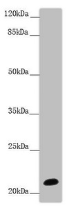 NCALD / Neurocalcin Delta Antibody - Western blot All Lanes:NCALD antibody at 9.32 ug/ml +Mouse brain tissue Secondary Goat polyclonal to rabbit IgG at 1/10000 dilution Predicted band size: 22 kDa Observed band size: 22 kDa