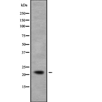 NCALD / Neurocalcin Delta Antibody - Western blot analysis NCALD using COS7 whole cells lysates