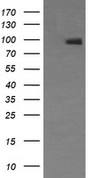 NCAM / CD56 Antibody - HEK293T cells were transfected with the pCMV6-ENTRY control (Left lane) or pCMV6-ENTRY NCAM1 (Right lane) cDNA for 48 hrs and lysed. Equivalent amounts of cell lysates (5 ug per lane) were separated by SDS-PAGE and immunoblotted with anti-NCAM1.
