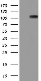 NCAM / CD56 Antibody - HEK293T cells were transfected with the pCMV6-ENTRY control. (Left lane) or pCMV6-ENTRY NCAM1. (Right lane) cDNA for 48 hrs and lysed. Equivalent amounts of cell lysates. (5 ug per lane) were separated by SDS-PAGE and immunoblotted with anti-NCAM1.