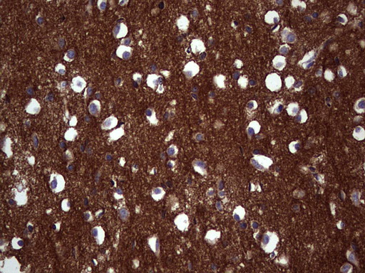 NCAM / CD56 Antibody - Immunohistochemical staining of paraffin-embedded Human adult brain tissue using anti-NCAM1 mouse monoclonal antibody. (Heat-induced epitope retrieval by 1 mM EDTA in 10mM Tris, pH8.5, 120C for 3min,