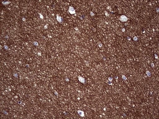 NCAM / CD56 Antibody - Immunohistochemical staining of paraffin-embedded Human embryonic brain cortex tissue using anti-NCAM1 mouse monoclonal antibody. (Heat-induced epitope retrieval by 1 mM EDTA in 10mM Tris, pH8.5, 120C for 3min,