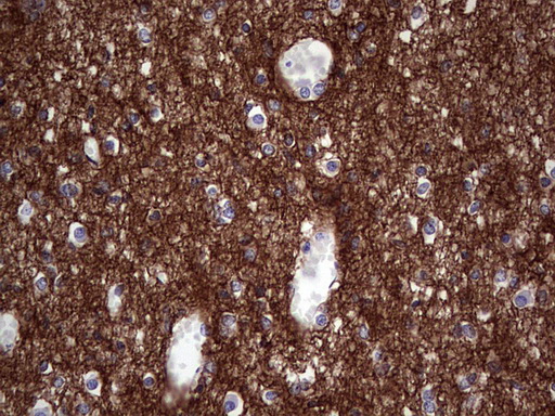 NCAM / CD56 Antibody - IHC of paraffin-embedded Human embryonic cerebellum using anti-NCAM1 mouse monoclonal antibody. (Heat-induced epitope retrieval by 1 mM EDTA in 10mM Tris, pH8.5, 120°C for 3min).