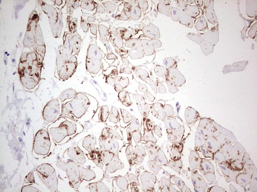 NCAM / CD56 Antibody - Immunohistochemical staining of paraffin-embedded Human adult heart tissue using anti-NCAM1 mouse monoclonal antibody. (Heat-induced epitope retrieval by 1 mM EDTA in 10mM Tris, pH8.5, 120C for 3min,