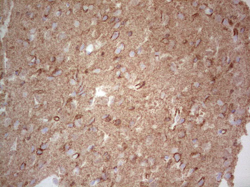 NCAM / CD56 Antibody - IHC of paraffin-embedded Human adult brain tissue using anti-NCAM1 mouse monoclonal antibody. (Heat-induced epitope retrieval by 1 mM EDTA in 10mM Tris, pH8.5, 120°C for 3min).