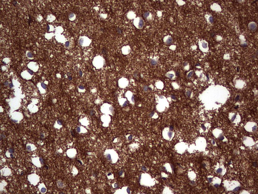 NCAM / CD56 Antibody - Immunohistochemical staining of paraffin-embedded Human adult brain tissue using anti-NCAM1 mouse monoclonal antibody. (Heat-induced epitope retrieval by 1 mM EDTA in 10mM Tris, pH8.5, 120C for 3min,