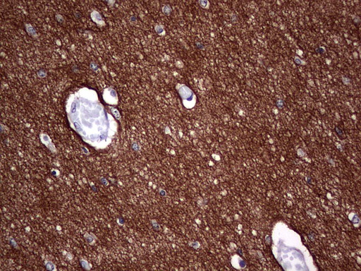 NCAM / CD56 Antibody - Immunohistochemical staining of paraffin-embedded Human embryonic brain cortex tissue using anti-NCAM1 mouse monoclonal antibody. (Heat-induced epitope retrieval by 1 mM EDTA in 10mM Tris, pH8.5, 120C for 3min,