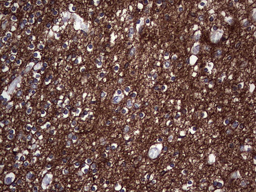 NCAM / CD56 Antibody - Immunohistochemical staining of paraffin-embedded Human embryonic cerebellum using anti-NCAM1 mouse monoclonal antibody. (Heat-induced epitope retrieval by 1 mM EDTA in 10mM Tris, pH8.5, 120C for 3min,