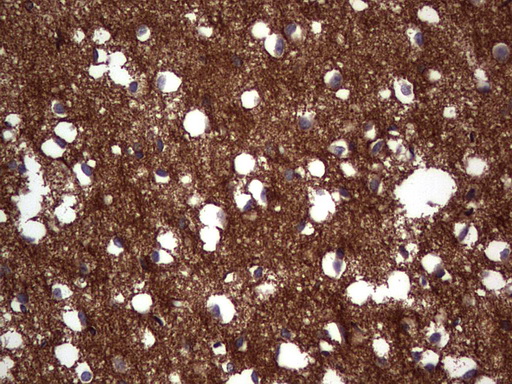 NCAM / CD56 Antibody - IHC of paraffin-embedded Human adult brain tissue using anti-NCAM1 mouse monoclonal antibody. (Heat-induced epitope retrieval by 1 mM EDTA in 10mM Tris, pH8.5, 120°C for 3min).