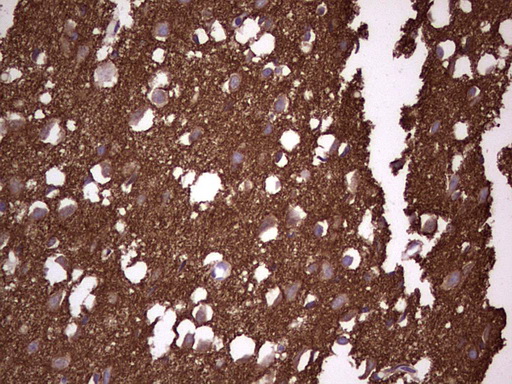 NCAM / CD56 Antibody - Immunohistochemical staining of paraffin-embedded Human adult brain tissue using anti-NCAM1 Mouse monoclonal antibody.  heat-induced epitope retrieval by 1 mM EDTA in 10mM Tris, pH8.5, 120C for 3min)