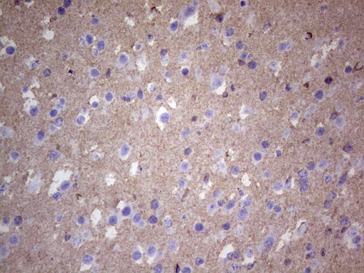 NCAM / CD56 Antibody - Immunohistochemical staining of paraffin-embedded Human embryonic brain cortex tissue using anti-NCAM1 Mouse monoclonal antibody.  heat-induced epitope retrieval by 1 mM EDTA in 10mM Tris, pH8.5, 120C for 3min)