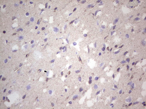 NCAM / CD56 Antibody - IHC of paraffin-embedded Human adult brain tissue using anti-NCAM1 Mouse monoclonal antibody. (heat-induced epitope retrieval by 1 mM EDTA in 10mM Tris, pH8.5, 120°C for 3min).