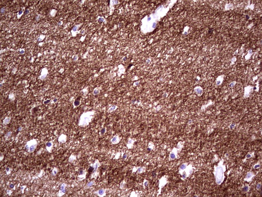 NCAM / CD56 Antibody - IHC of paraffin-embedded Human embryonic brain cortex tissue using anti-NCAM1 Mouse monoclonal antibody. (heat-induced epitope retrieval by 1 mM EDTA in 10mM Tris, pH8.5, 120°C for 3min).