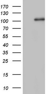 NCAM / CD56 Antibody - HEK293T cells were transfected with the pCMV6-ENTRY control (Left lane) or pCMV6-ENTRY NCAM1 (Right lane) cDNA for 48 hrs and lysed. Equivalent amounts of cell lysates (5 ug per lane) were separated by SDS-PAGE and immunoblotted with anti-NCAM1.