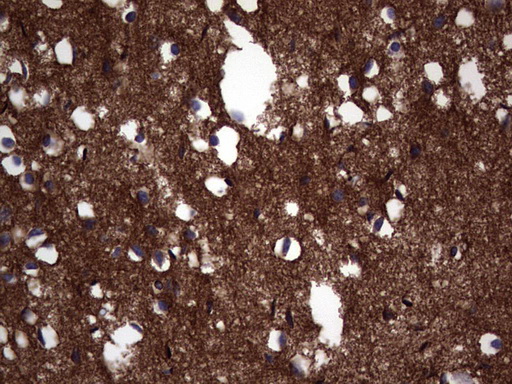 NCAM / CD56 Antibody - IHC of paraffin-embedded Human adult brain tissue using anti-NCAM1 mouse monoclonal antibody. (Heat-induced epitope retrieval by 1 mM EDTA in 10mM Tris, pH8.5, 120°C for 3min).