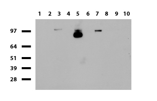 NCAM / CD56 Antibody - Western blot of human tissue lysates. (15ug) from 10 different tissues. (1: Testis, 2: Omentum, 3: Uterus, 4: Breast, 5: Brain, 6: Liver, 7: Ovary, 8: Thyroid 9: Colon, 10: Spleen). Diluation: 1:500.