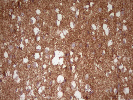 NCAM / CD56 Antibody - Immunohistochemical staining of paraffin-embedded Human adult brain tissue using anti-NCAM1 mouse monoclonal antibody. (Heat-induced epitope retrieval by 1mM EDTA in 10mM Tris buffer. (pH8.0) at 120C for 3 min. (1:200)