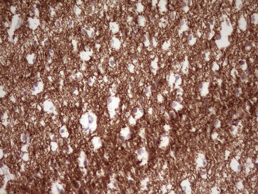 NCAM / CD56 Antibody - Immunohistochemical staining of paraffin-embedded Human embryonic brain cortex tissue using anti-NCAM1 mouse monoclonal antibody. (Heat-induced epitope retrieval by 1mM EDTA in 10mM Tris buffer. (pH8.0) at 120C for 3 min. (1:200)