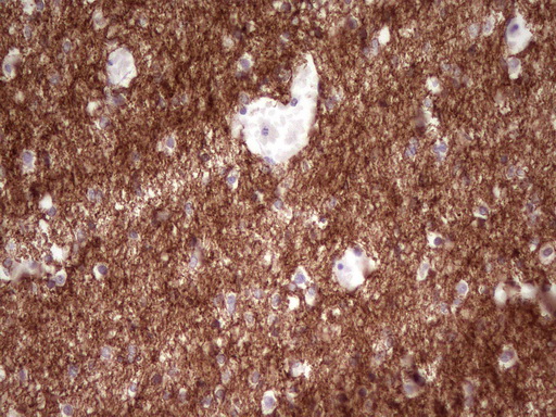NCAM / CD56 Antibody - Immunohistochemical staining of paraffin-embedded Human embryonic cerebellum using anti-NCAM1 mouse monoclonal antibody. (Heat-induced epitope retrieval by 1mM EDTA in 10mM Tris buffer. (pH8.0) at 120C for 3 min. (1:200)