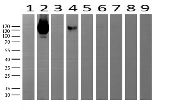 NCAM / CD56 Antibody - Western blot analysis of extracts. (15ug) from 9 Human tissue by using anti-NCAM1 monoclonal antibody. (1: Testis; 2: Uterus; 3: Breast; 4: Brain; 5: Liver; 6: Ovary; 7: Thyroid gland; 8: colon:;9:Spleen). (1:500) Dilution: 1:500