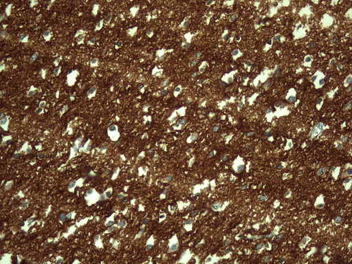 NCAM / CD56 Antibody - Immunohistochemical staining of paraffin-embedded Human embryonic brain cortex tissue using anti-NCAM1 mouse monoclonal antibody. (Heat-induced epitope retrieval by 1mM EDTA in 10mM Tris buffer. (pH8.0) at 110C for 10 min. (1:400)