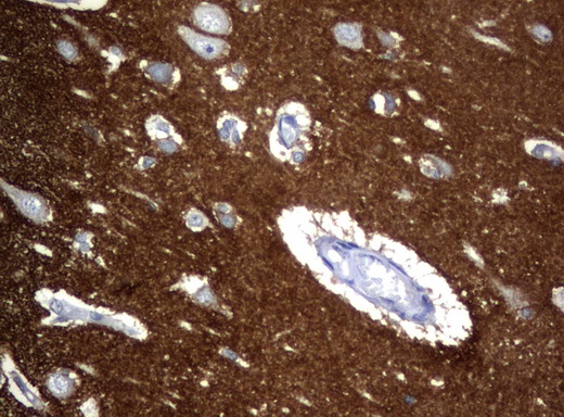 NCAM / CD56 Antibody - Immunohistochemical staining of paraffin-embedded Human adult brain tissue using anti-NCAM1 mouse monoclonal antibody.  heat-induced epitope retrieval by 10mM citric buffer, pH6.0, 120C for 3min)