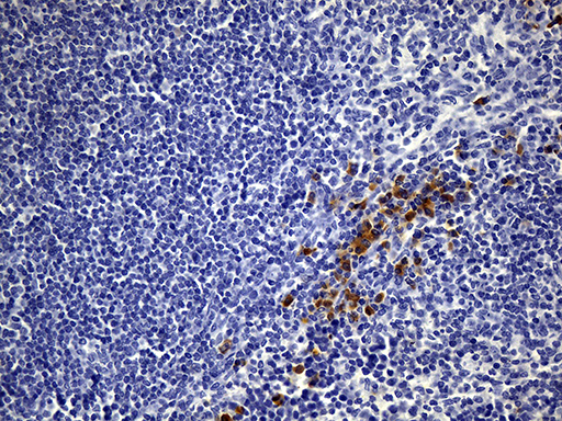 NCAM / CD56 Antibody - Immunohistochemical staining of paraffin-embedded mouse spleen tissue using anti-NCAM1 clone UMAB83 mouse monoclonal antibody. (Heat-induced epitope retrieval by 1mM EDTA in 10mM Tris buffer. (pH8.5) at 120 oC for 3 min. (1:300)