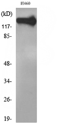 NCAM / CD56 Antibody - Western blot analysis of lysate from H460 cells, using NCAM1 Antibody.