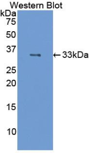 NCAM / CD56 Antibody - Western blot of recombinant NCAM / CD56.