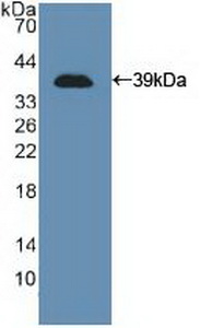 NCAM / CD56 Antibody - Western Blot; Sample: Recombinant NCAM, Human.