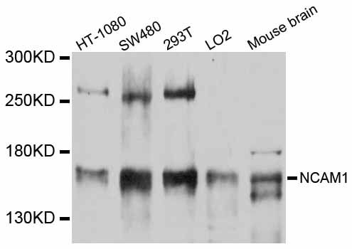 NCAM / CD56 Antibody - Western blot analysis of extracts of various cell lines, using NCAM1 antibody at 1:3000 dilution. The secondary antibody used was an HRP Goat Anti-Rabbit IgG (H+L) at 1:10000 dilution. Lysates were loaded 25ug per lane and 3% nonfat dry milk in TBST was used for blocking. An ECL Kit was used for detection and the exposure time was 30s.