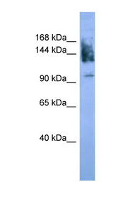 NCAM / CD56 Antibody - NCAM1 / CD56 antibody Western blot of Fetal Brain lysate.  This image was taken for the unconjugated form of this product. Other forms have not been tested.