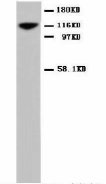 NCAM / CD56 Antibody -  This image was taken for the unconjugated form of this product. Other forms have not been tested.