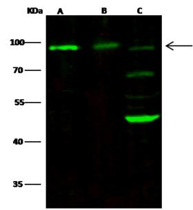 NCAM / CD56 Antibody - Anti-NCAM1 rabbit monoclonal antibody at 1:500 dilution. Lane A: Jurkat Whole Cell Lysate. Lane B: SH-SY5Y Whole Cell Lysate. Lane C: Mouse brain Tissue Lysate. Lysates/proteins at 30 ug per lane. Secondary: Goat Anti-Rabbit IgG H&L (Dylight800) at 1/10000 dilution. Developed using the Odyssey technique. Performed under reducing conditions. Predicted band size: 93 kDa. Observed band size: 93 kDa. (We are unsure as to the identity of these extra bands.)