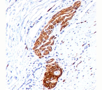 NCAM / CD56 Antibody - NCAM CD56 antibody 123C3.D5 immunohistochemistry colon ganglion.  This image was taken for the unmodified form of this product. Other forms have not been tested.