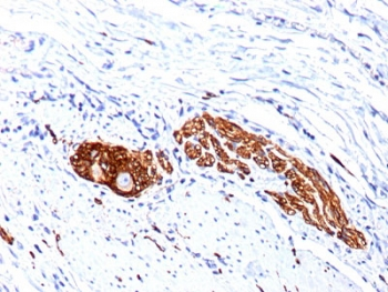 NCAM / CD56 Antibody - IHC staining of FFPE human colon ganglion with CD56 antibody (clone 56C04 + 123C.D5). HIER: boil tissue sections in pH6, 10mM citrate buffer, for 10-20 min followed by cooling at RT for 20 min.