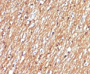 NCAM / CD56 Antibody - IHC testing of FFPE human brain tumor with CD56 antibody (clone CDLA56).  This image was taken for the unmodified form of this product. Other forms have not been tested.